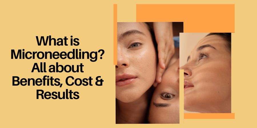 Read more about the article What is Microneedling? All about Benefits, Cost & Results